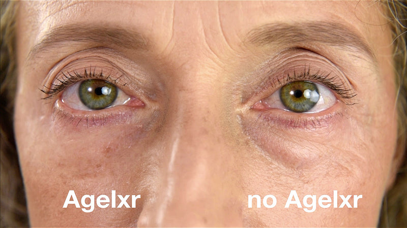 Normale Anti-Aging-Cremes brauchen Monate. Wenn sie überhaupt wirken.